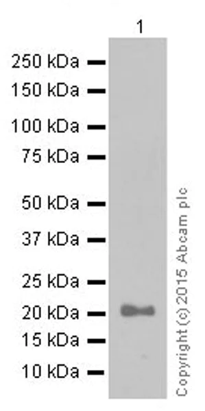 Western blot - Anti-Claudin 5 antibody [EPR7583] (AB131259)