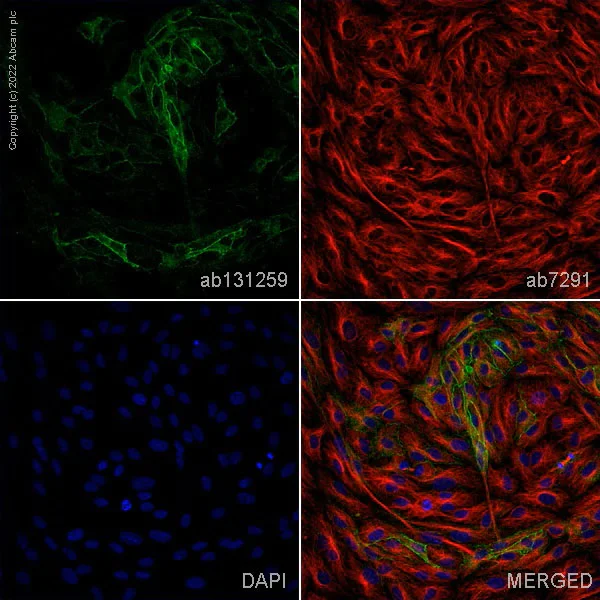 Immunocytochemistry/ Immunofluorescence - Anti-Claudin 5 antibody [EPR7583] - BSA and Azide free (AB236066)