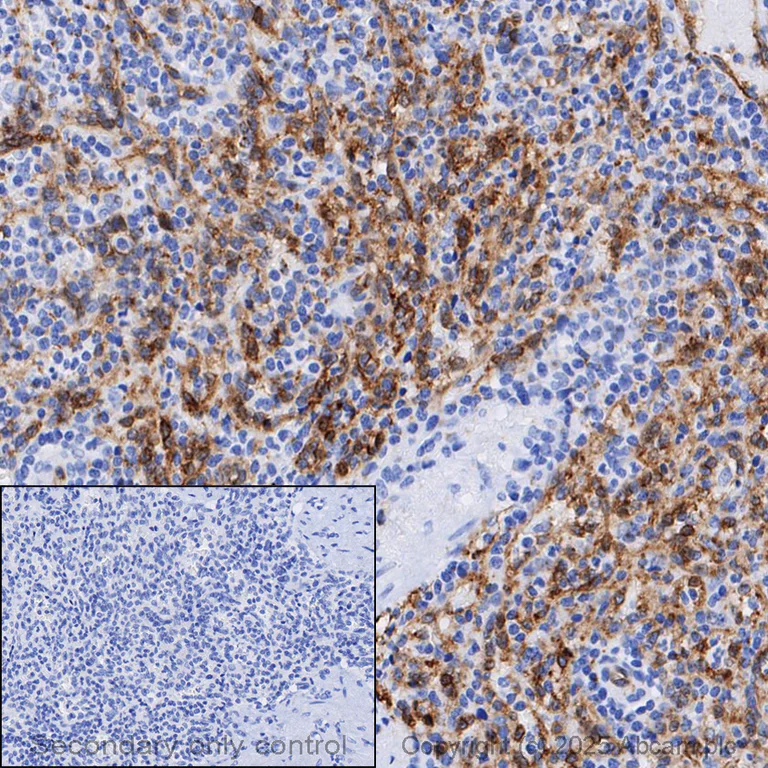 Immunohistochemistry (Formalin/PFA-fixed paraffin-embedded sections) - Anti-Claudin 5 antibody [EPR7583] - BSA and Azide free (AB236066)