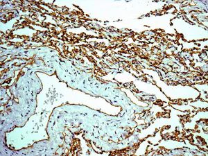 Immunohistochemistry (Formalin/PFA-fixed paraffin-embedded sections) - Anti-Claudin 5 antibody [EPR7583] - BSA and Azide free (AB236066)