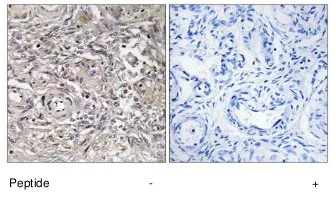 Immunohistochemistry (Formalin/PFA-fixed paraffin-embedded sections) - Anti-Claudin 6 antibody (AB75055)