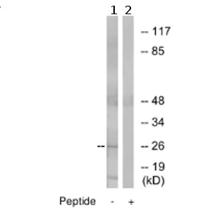 Western blot - Anti-Claudin 6 antibody (AB75055)