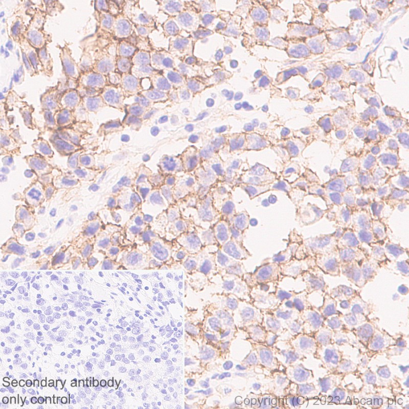 Immunohistochemistry (Formalin/PFA-fixed paraffin-embedded sections) - Anti-Claudin 6 antibody [EPR28103-113] (ab314134), expandable thumbnail
