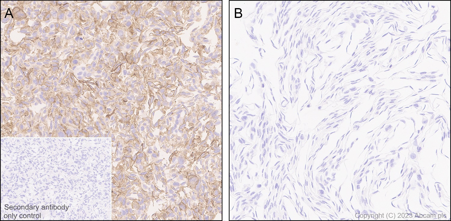 Immunohistochemistry (Formalin/PFA-fixed paraffin-embedded sections) - Anti-Claudin 6 antibody [EPR28103-113] (ab314134), expandable thumbnail