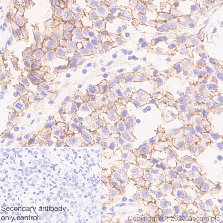 Immunohistochemistry (Formalin/PFA-fixed paraffin-embedded sections) - Anti-Claudin 6 antibody [EPR28103-113] - BSA and Azide free (AB314135)