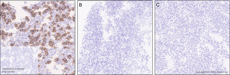 Immunohistochemistry (Formalin/PFA-fixed paraffin-embedded sections) - Anti-Claudin 6 antibody [EPR28103-113] - BSA and Azide free (AB314135)