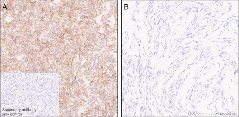 Immunohistochemistry (Formalin/PFA-fixed paraffin-embedded sections) - Anti-Claudin 6 antibody [EPR28103-113] - BSA and Azide free (AB314135)