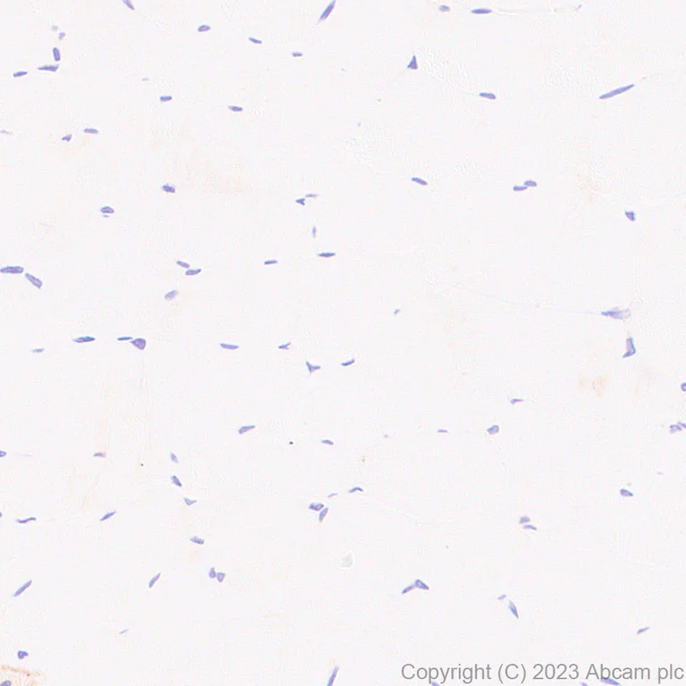 Immunohistochemistry (Formalin/PFA-fixed paraffin-embedded sections) - Anti-Claudin 6 antibody [EPR28103-113] - BSA and Azide free (AB314135)