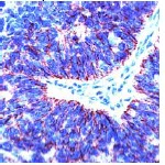 Immunohistochemistry (Formalin/PFA-fixed paraffin-embedded sections) - Anti-Claudin 7/CLDN-7 antibody (AB27487)