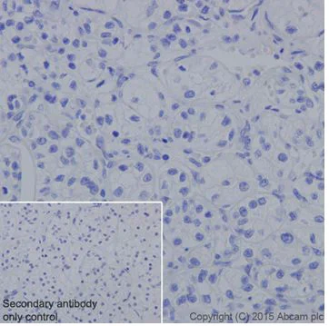 Immunohistochemistry (Formalin/PFA-fixed paraffin-embedded sections) - Anti-Claudin 7/CLDN-7 antibody [EPR18073] (AB207300)