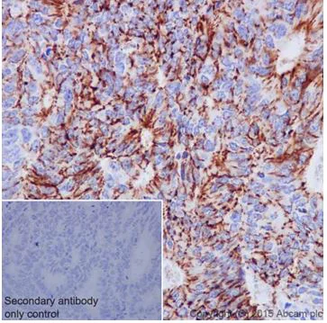Immunohistochemistry (Formalin/PFA-fixed paraffin-embedded sections) - Anti-Claudin 7/CLDN-7 antibody [EPR18073] - BSA and Azide free (AB214576)