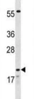Western blot - Anti-Claudin 8 antibody (AB211439)