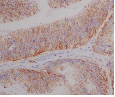 Immunohistochemistry (Formalin/PFA-fixed paraffin-embedded sections) - Anti-Claudin 8 antibody [EPR12680(2)] (AB183738), expandable thumbnail