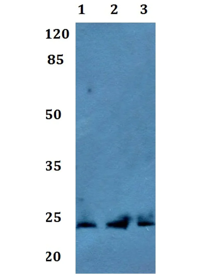 Western blot - Anti-Claudin 9 antibody (AB192398)
