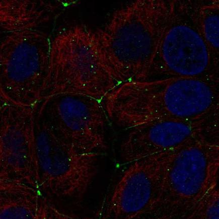 Immunocytochemistry/ Immunofluorescence - Anti-Claudin 9 antibody (AB222300), expandable thumbnail