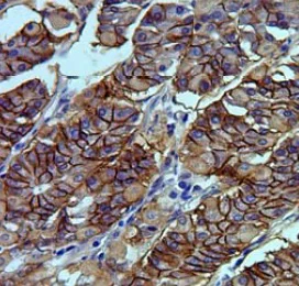 Immunohistochemistry (Formalin/PFA-fixed paraffin-embedded sections) - Anti-Claudin18 antibody [34H14L15] (AB203563)