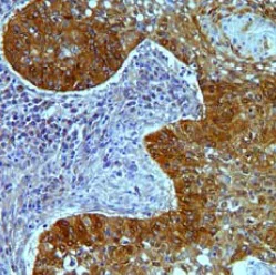 Immunohistochemistry (Formalin/PFA-fixed paraffin-embedded sections) - Anti-Claudin18 antibody [34H14L15] (AB203563)