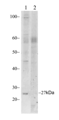 Western blot - Anti-Claudin18 antibody [34H14L15] (AB203563)