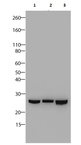 Western blot - Anti-Claudin18 antibody [34H14L15] (AB203563)