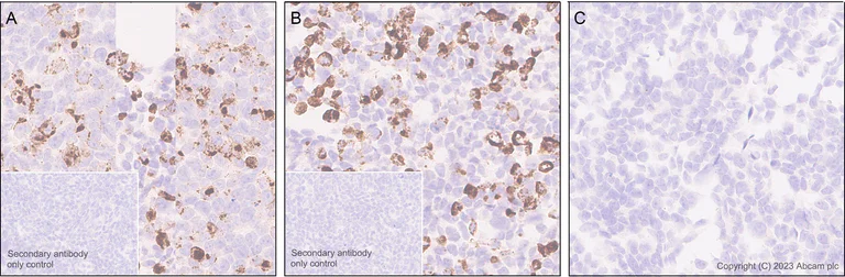 Immunohistochemistry (Formalin/PFA-fixed paraffin-embedded sections) - Anti-Claudin18 antibody [43-14A] (AB314690)