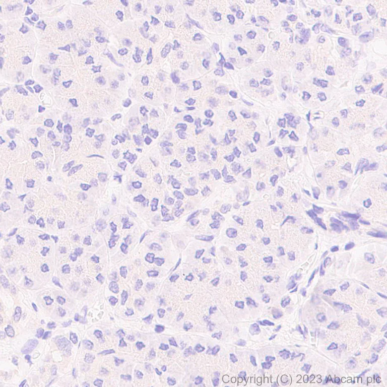 Immunohistochemistry (Formalin/PFA-fixed paraffin-embedded sections) - Anti-Claudin18 antibody [43-14A] (AB314690)