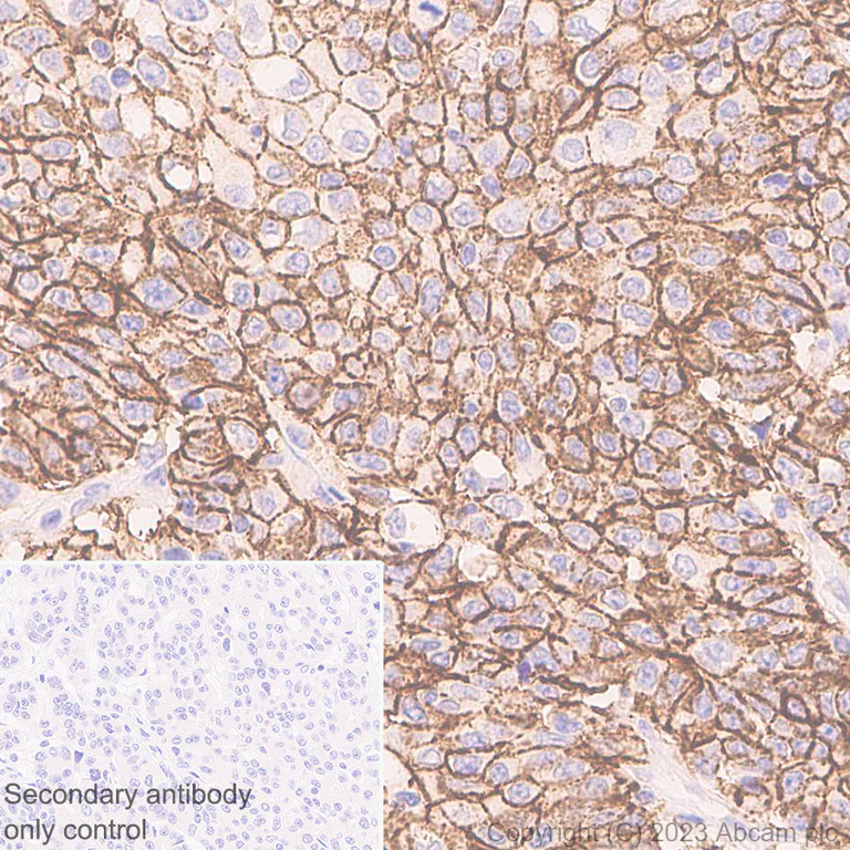 Immunohistochemistry (Formalin/PFA-fixed paraffin-embedded sections) - Anti-Claudin18 antibody [43-14A] (AB314690)