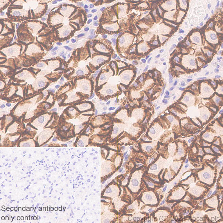 Immunohistochemistry (Formalin/PFA-fixed paraffin-embedded sections) - Anti-Claudin18 antibody [43-14A] (AB314690)
