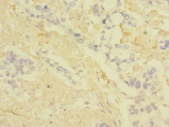Immunohistochemistry (Formalin/PFA-fixed paraffin-embedded sections) - Anti-Claudin18 antibody (AB230179)