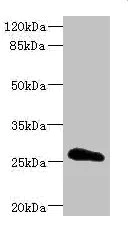 Western blot - Anti-Claudin18 antibody (AB230179)