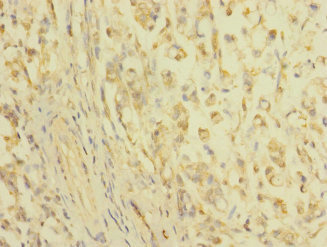 Immunohistochemistry (Formalin/PFA-fixed paraffin-embedded sections) - Anti-Claudin18 antibody (AB230224)