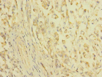 Immunohistochemistry (Formalin/PFA-fixed paraffin-embedded sections) - Anti-Claudin18 antibody (AB230224)