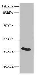 Western blot - Anti-Claudin18 antibody (AB230224)