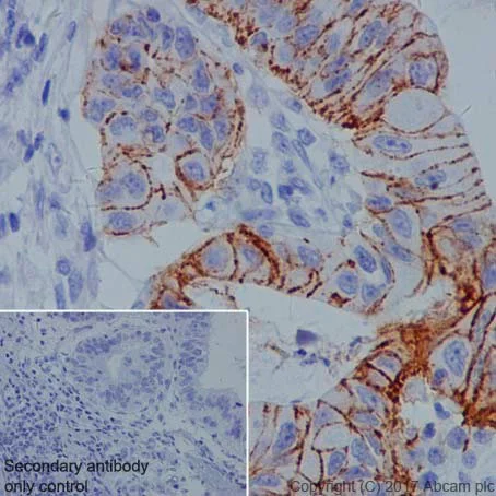 Immunohistochemistry (Formalin/PFA-fixed paraffin-embedded sections) - Anti-Claudin18.2 + Claudin18.1 antibody [EPR19203] (AB222513)