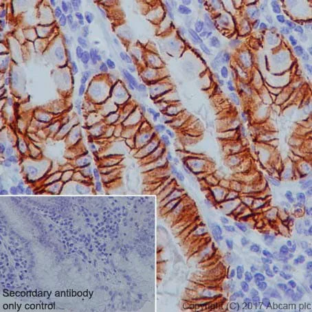 Immunohistochemistry (Formalin/PFA-fixed paraffin-embedded sections) - Anti-Claudin18.2 + Claudin18.1 antibody [EPR19203] (AB222513)