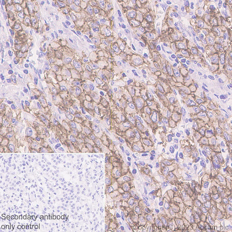 Immunohistochemistry (Formalin/PFA-fixed paraffin-embedded sections) - Anti-Claudin18.2 + Claudin18.1 antibody [EPR19203] (AB222513)