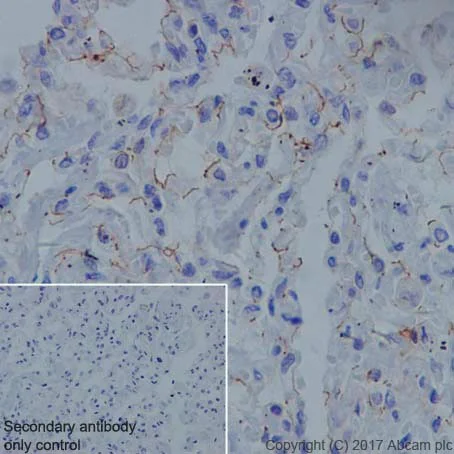 Immunohistochemistry (Formalin/PFA-fixed paraffin-embedded sections) - Anti-Claudin18.2 + Claudin18.1 antibody [EPR19203] (AB222513)