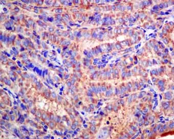 Immunohistochemistry (Formalin/PFA-fixed paraffin-embedded sections) - Anti-ClC-2 antibody [EPR6492(2)] - BSA and Azide free (AB249106)