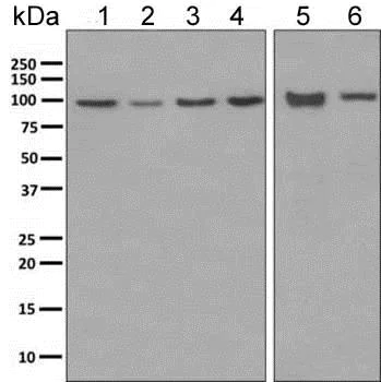 Western blot - Anti-ClC-2 antibody [EPR6492(2)] - BSA and Azide free (AB249106)