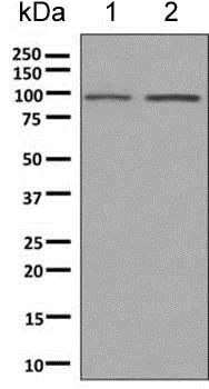 Western blot - Anti-ClC-2 antibody [EPR6492(2)] - BSA and Azide free (AB249106)