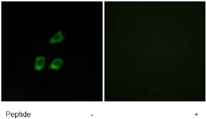 Immunocytochemistry/ Immunofluorescence - Anti-ClC-4 antibody (AB75008)