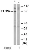 Western blot - Anti-ClC-4 antibody (AB75008)
