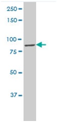 Western blot - Anti-CLC7 antibody - C-terminal (AB194433), expandable thumbnail