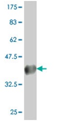 Western blot - Anti-CLC7 antibody - C-terminal (AB194433), expandable thumbnail