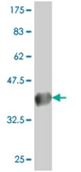 Western blot - Anti-CLC7 antibody - C-terminal (AB194433)