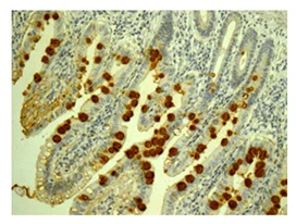 Immunohistochemistry (Formalin/PFA-fixed paraffin-embedded sections) - Anti-CLCA1 antibody [EPR12254-88] (AB180851)