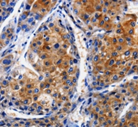 Immunohistochemistry (Formalin/PFA-fixed paraffin-embedded sections) - Anti-CLCA4 antibody (AB197347)