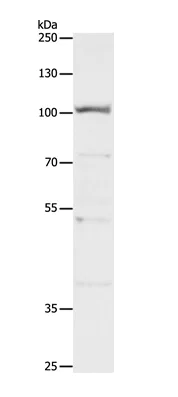 Western blot - Anti-CLCA4 antibody (AB197347)