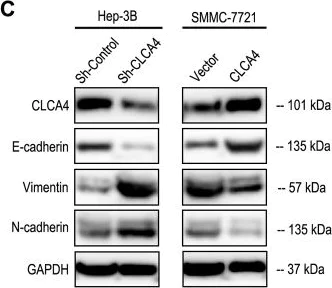 Western blot - Anti-CLCA4 antibody (AB197347)