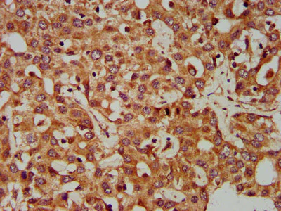 Immunohistochemistry (Formalin/PFA-fixed paraffin-embedded sections) - Anti-CLCC1 antibody (AB237755)