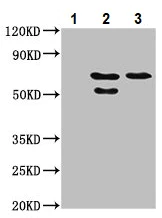 Immunoprecipitation - Anti-CLCC1 antibody (AB237755)
